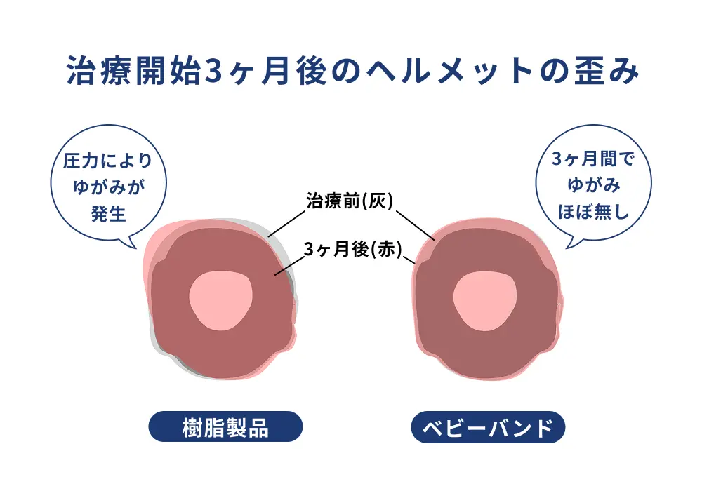 ヘルメットの形状変化のイメージ