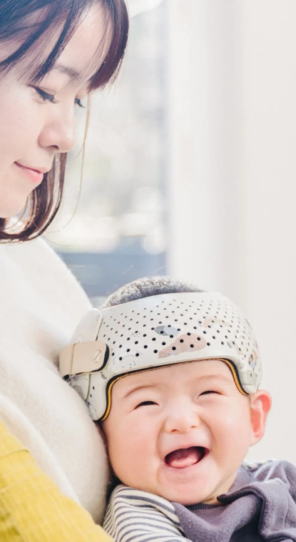 赤ちゃんの頭の形を治療する頭蓋形状矯正ヘルメット ベビーバンド（babyband）